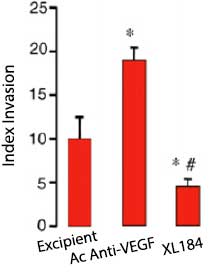 Figure 4. Tumeurs RIP-Tag2 : Risque invasif après traitement par cabozantinib (XL 184) [2]