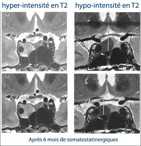 L'image commentée