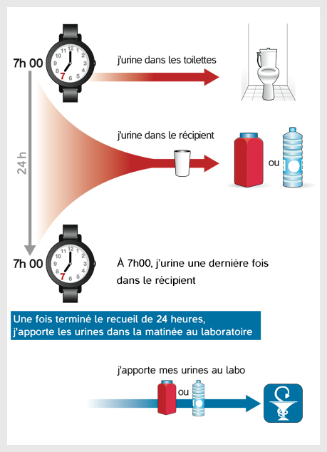 Examen d'urine - détection du syndrome de cushing par analyse d ...