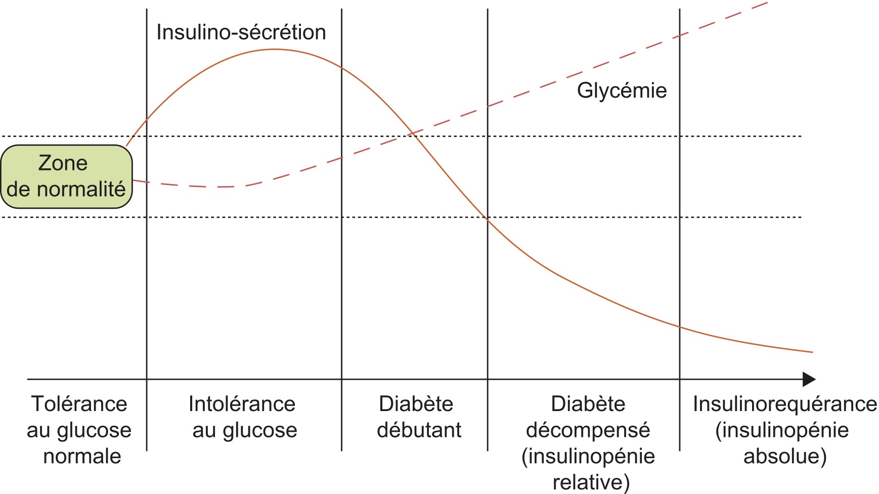 Diabète de type 2 - Société Française d'Endocrinologie